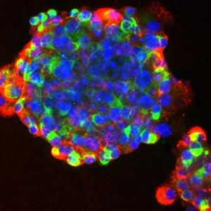 The great stem cell debate