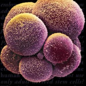 TIME TO END EMBRYONIC STEM CELL RESEARCH??